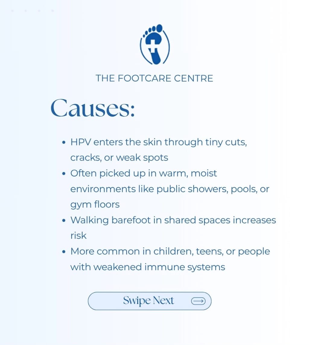 Plantar Warts Causes